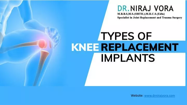 Ppt Types Of Knee Replacement Implants Dr Niraj Vora Powerpoint