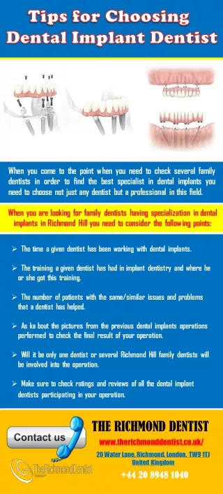 Tips for Choosing Dental Implant Dentist