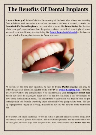 the benefits of dental implants