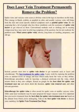 does laser vein treatment permanently remove