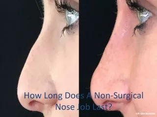 How Long Does A Non-Surgical Nose Job Last?