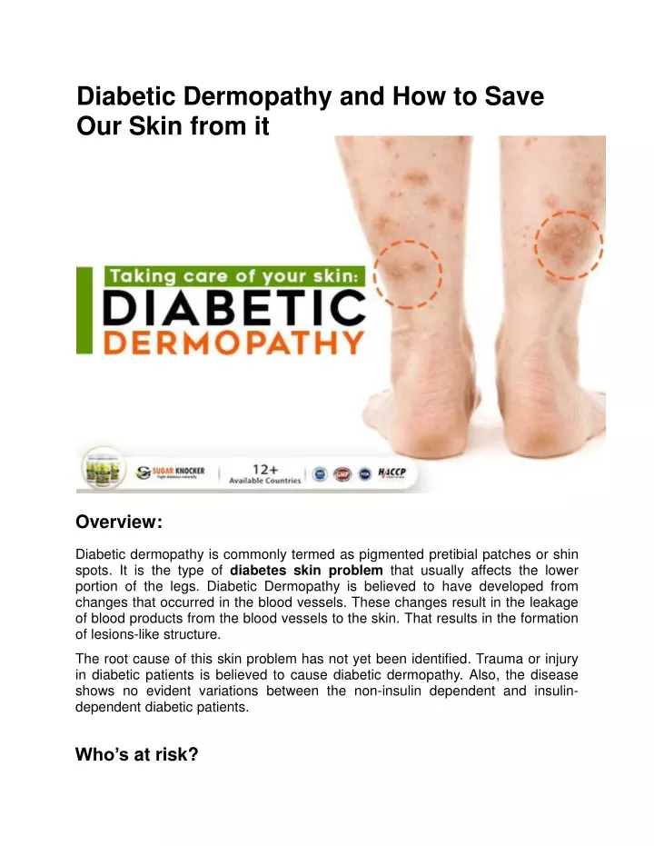 diabetic dermopathy and how to save our skin from