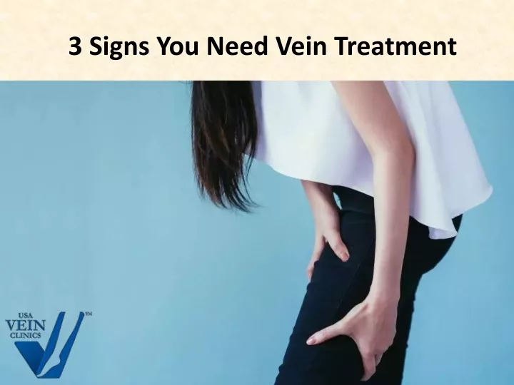 3 signs you need vein treatment