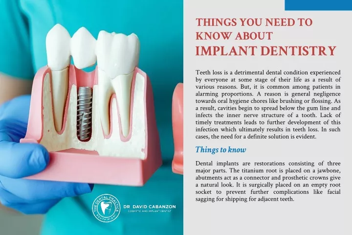 things you need to know about implant dentistry