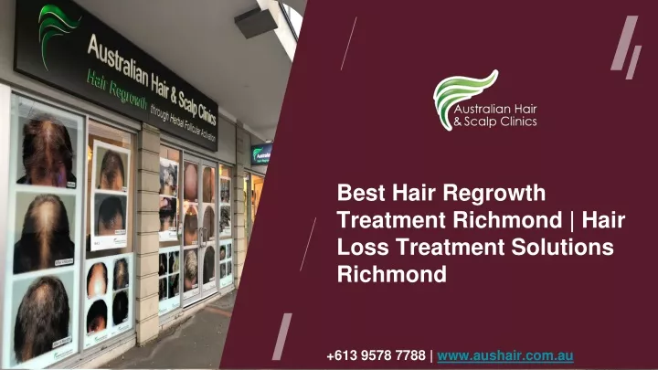 best hair regrowth treatmen t richmond hair loss
