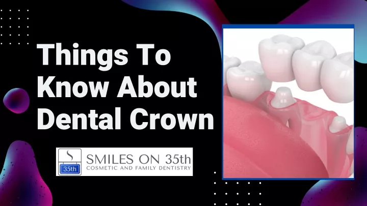 things to know about dental crown