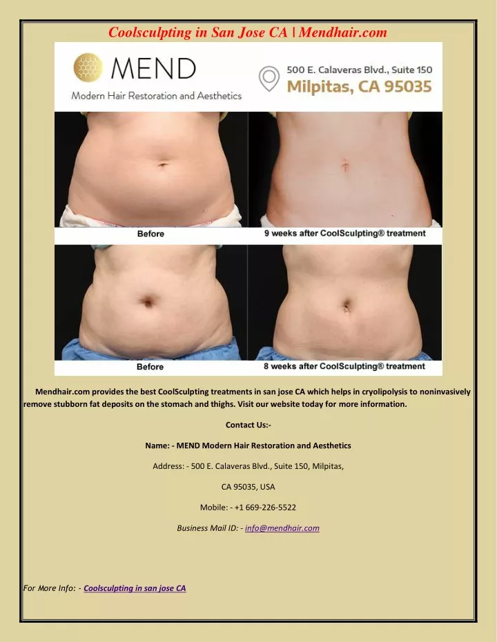 coolsculpting in san jose ca mendhair com