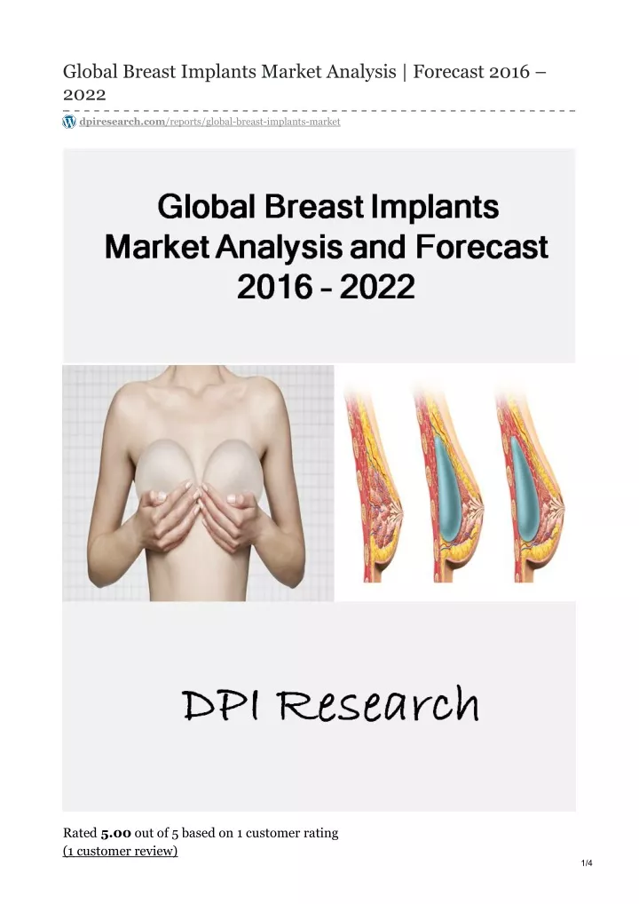 global breast implants market analysis forecast