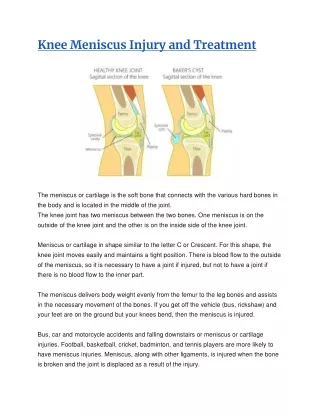 Knee Meniscus Injury and Treatment