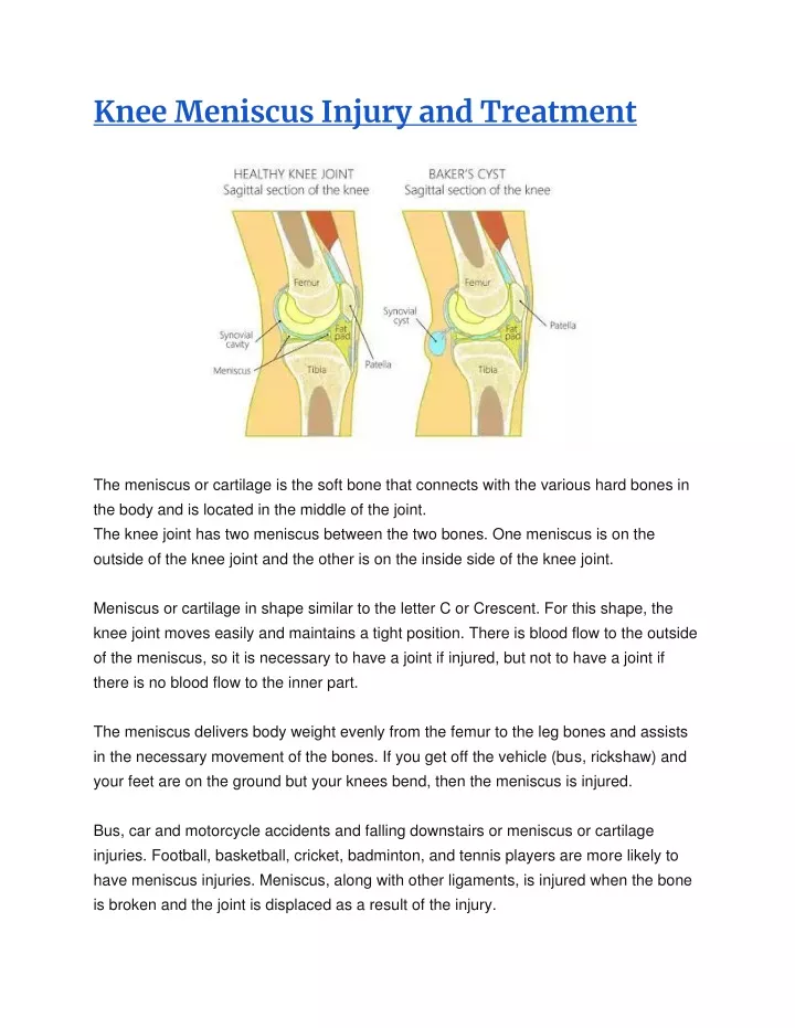knee meniscus injury and treatment
