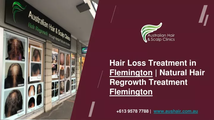 hair loss treatmen t in flemington natural hair