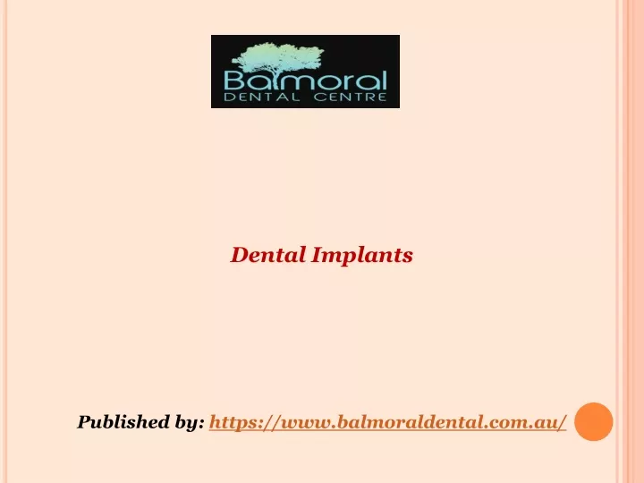 dental implants published by https