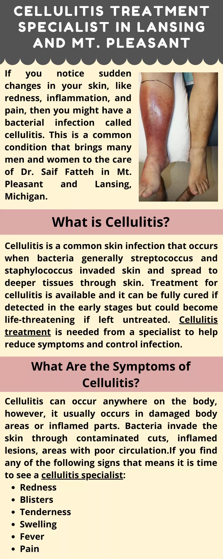 cellulitis treatment specialist in lansing