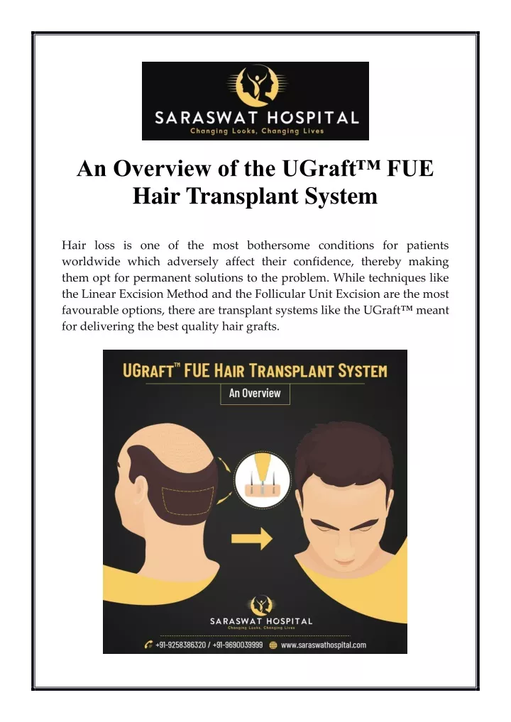 an overview of the ugraft fue hair transplant