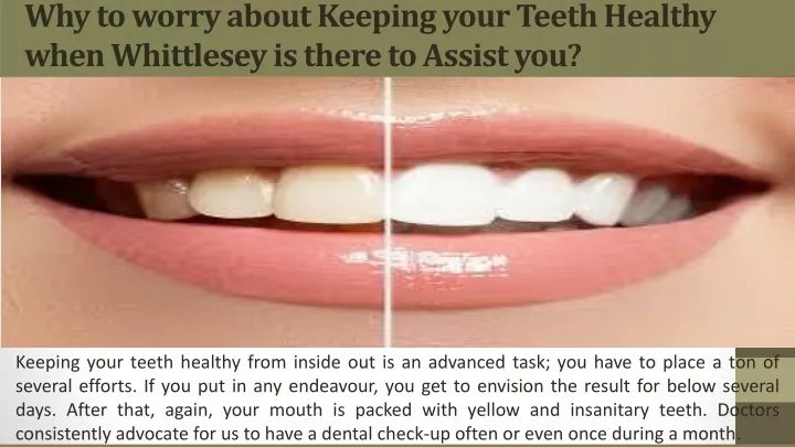 why to worry about keeping your teeth healthy when whittlesey is there to assist you