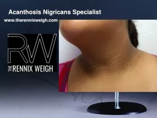 Acanthosis Nigricans Specialist - http://www.therennixweigh.com/