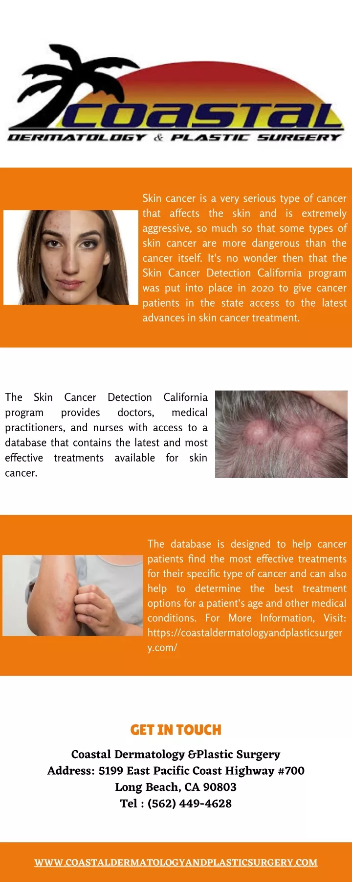 skin cancer is a very serious type of cancer that