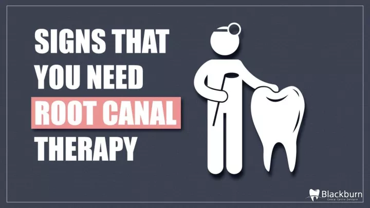 signs that you need root canal therapy