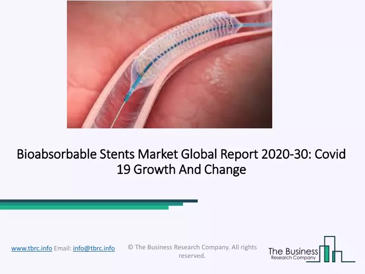 bioabsorbable stents market global report 2020 30 covid 19 growth and change