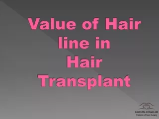 Value of Hair Line in Hair Transplant