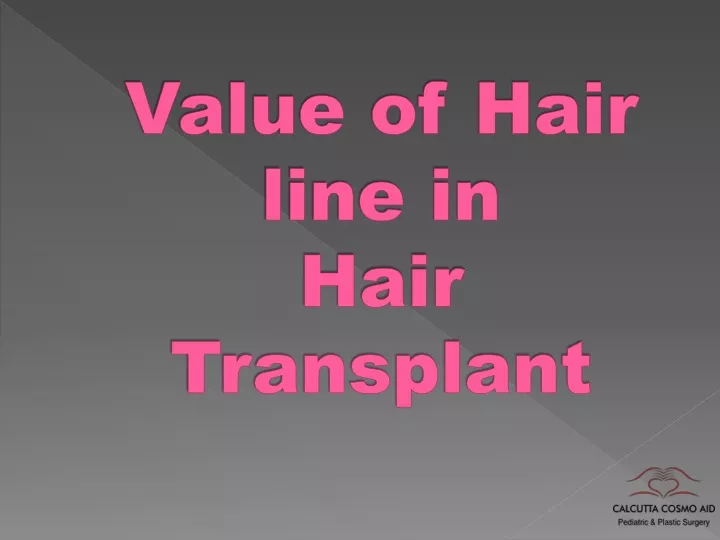 value of hair line in hair transplant