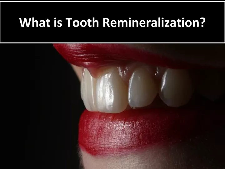 what is tooth remineralization