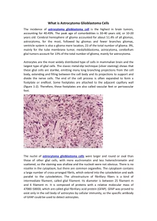 what is astrocytoma glioblastoma cells