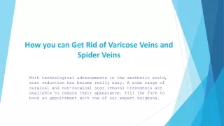 how you can get rid of varicose veins and spider veins