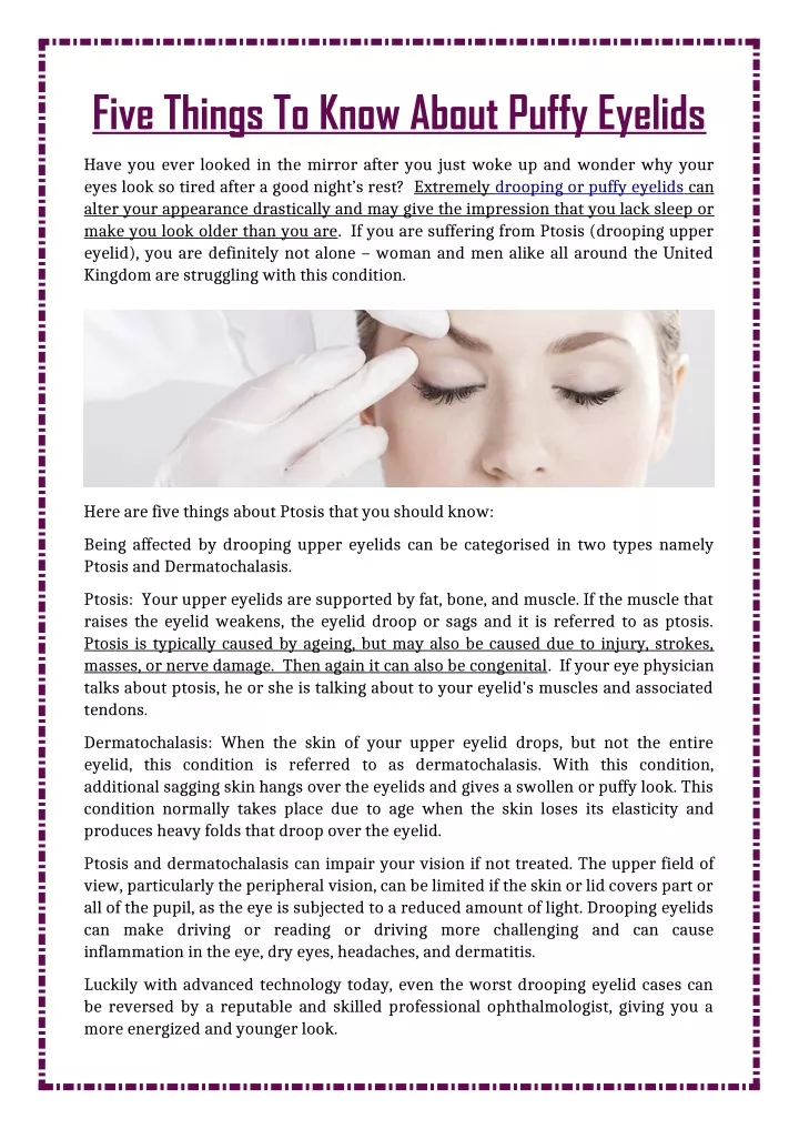 five things to know about puffy eyelids