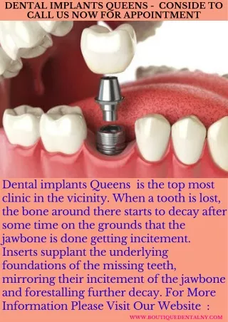 Dental Implants Queens -  Conside To Call Us Now For Appointment