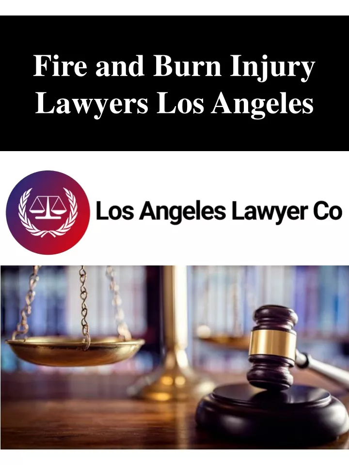fire and burn injury lawyers los angeles
