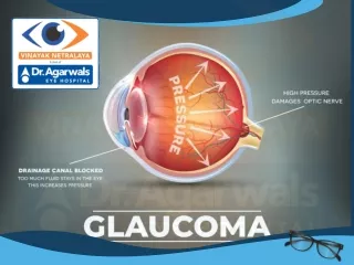 Glaucoma | Glaucoma Surgery, Glaucoma Eye Surgery Centre |  Glaucoma Center in Indore,