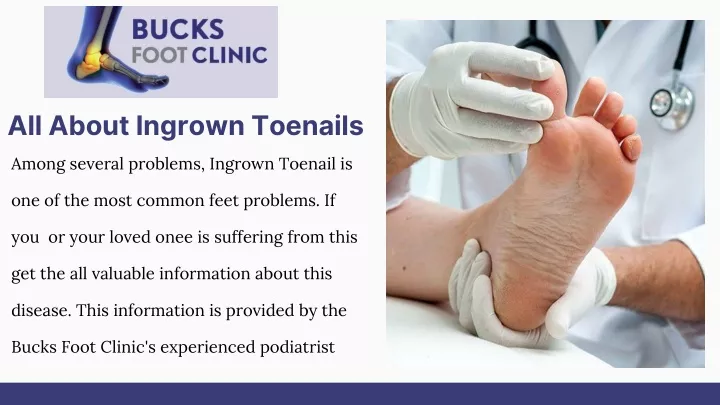 all about ingrown toenails