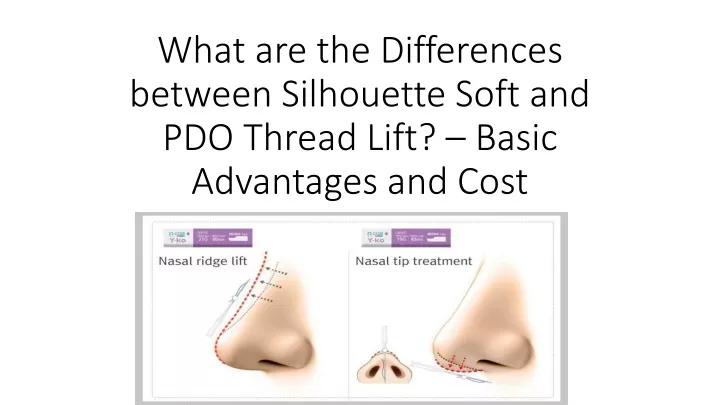 what are the differences between silhouette soft and pdo thread lift basic advantages and cost