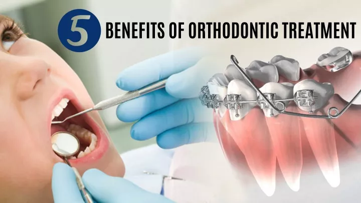 benefits of orthodontic treatment
