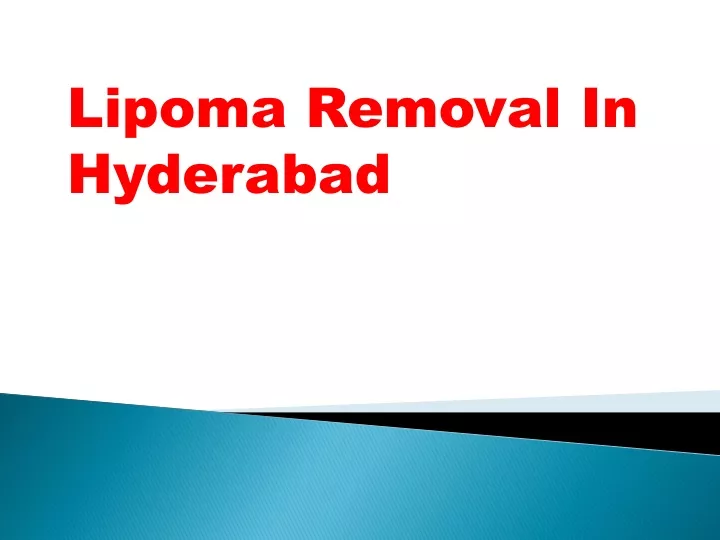 lipoma removal in hyderabad