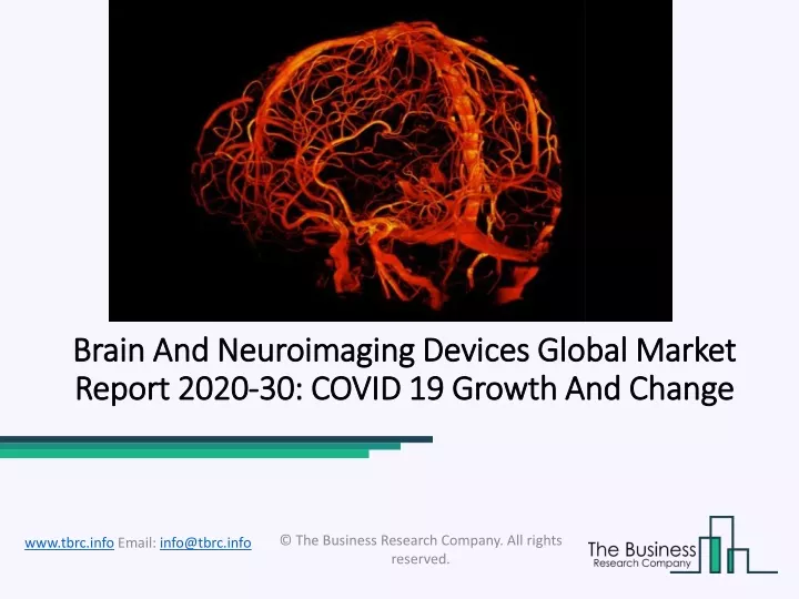 brain and neuroimaging devices global market report 2020 30 covid 19 growth and change