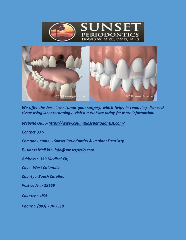 PPT - Full Mouth Reconstruction In Columbia, SC ...