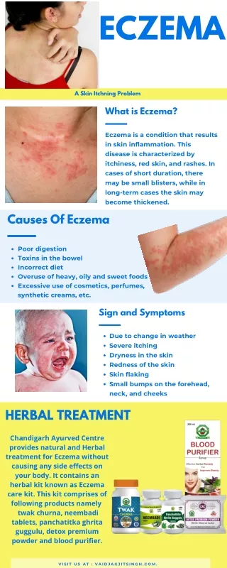 Eczema- Causes, Symptoms and Treatment