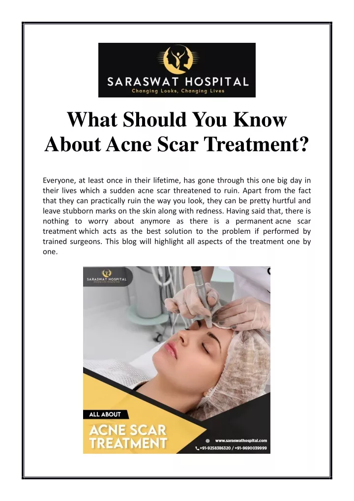 what should you know about acne scar treatment