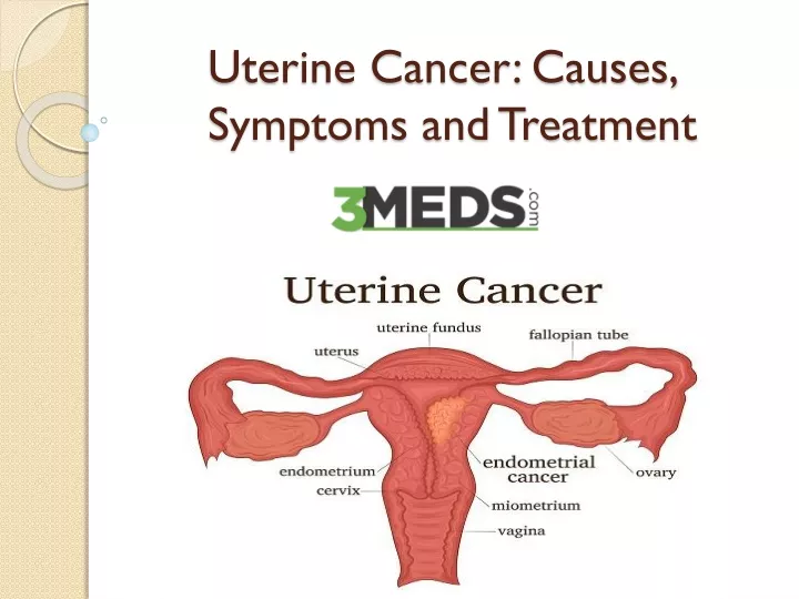 uterine cancer causes symptoms and treatment
