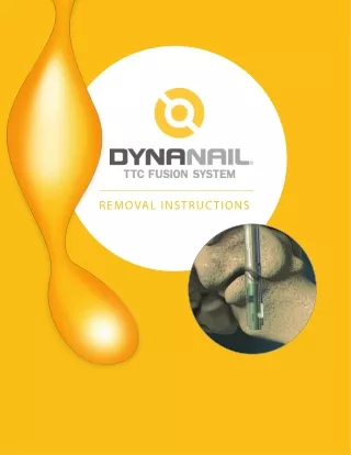 DynaNail® TTC Fusion System - Removal Instructions