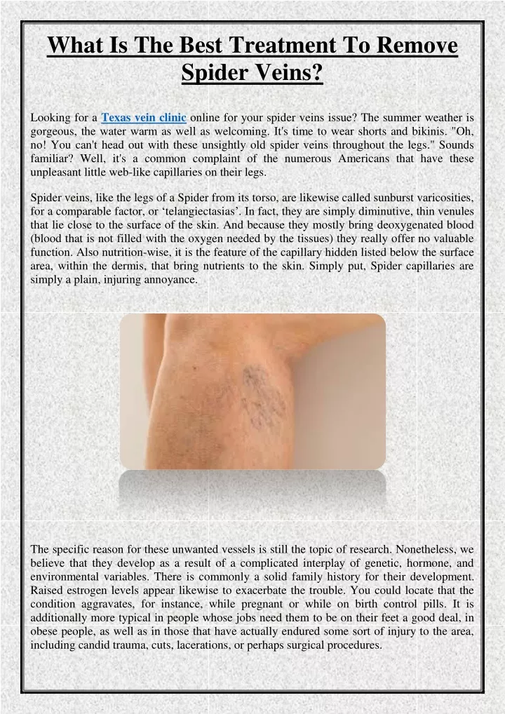 what is the best treatment to remove spider veins