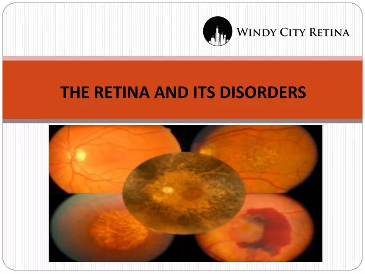 the retina and its disorders
