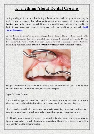 everything about dental crowns