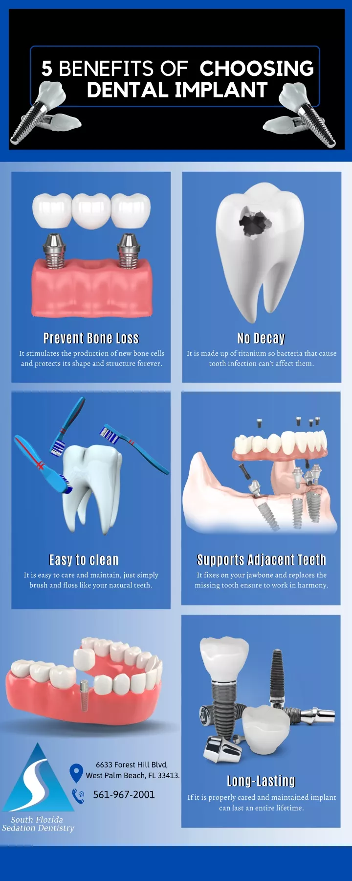 5 benefits of choosing dental implant