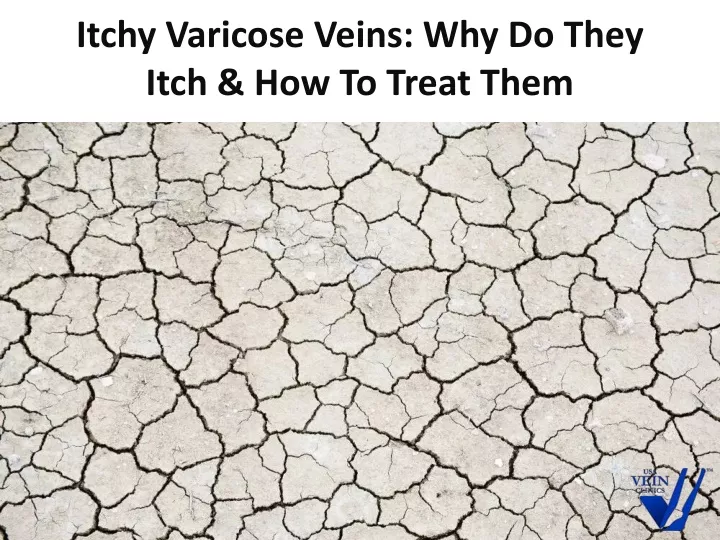 itchy varicose veins why do they itch