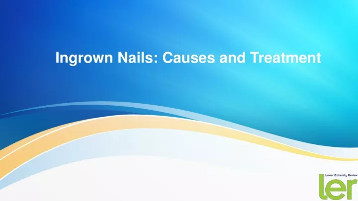 ingrown nails causes and treatment