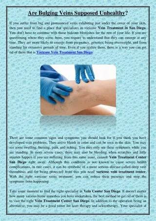 are bulging veins supposed unhealthy
