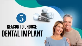 5 Reason to Choose Dental Implant